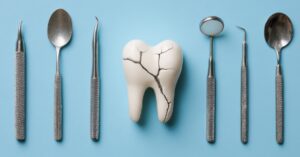 cracked tooth