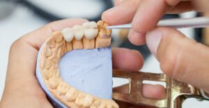 dental bridge last longer