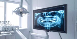 Are Dental X-Rays Safe?